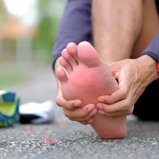 Paciente con dolor de talón por fascitis plantar en Armenia, Quindío