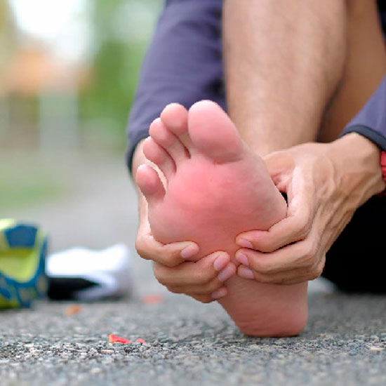 Paciente con dolor en la planta del pie por fascitis plantar